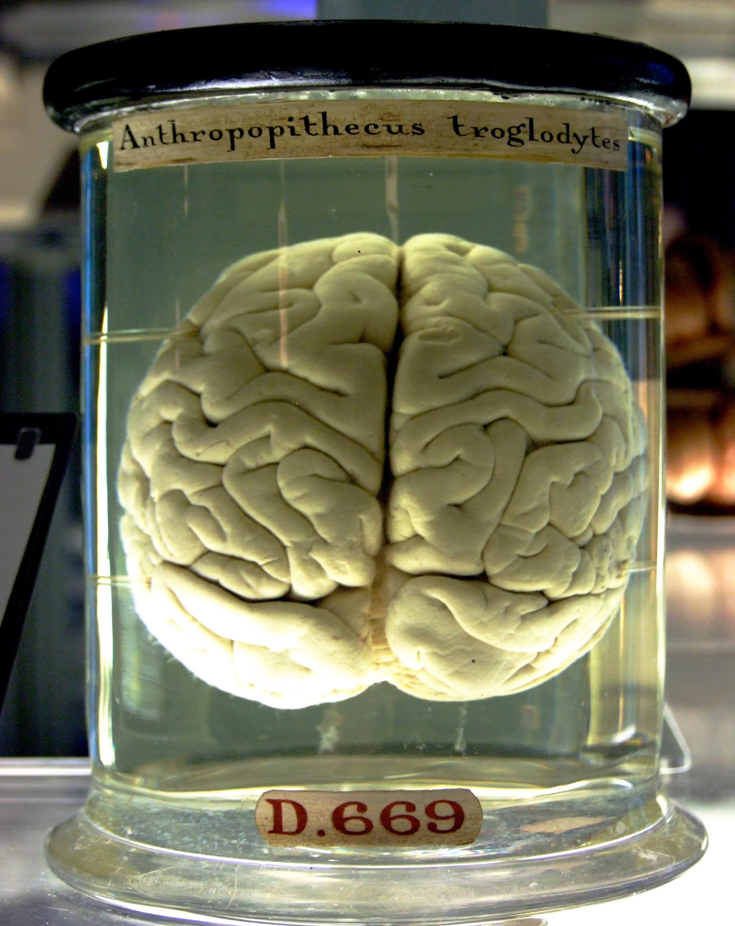 Image of a Chimp Brain